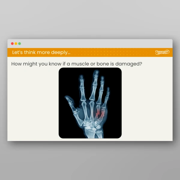 An image of the Lesson 6: How Do Our Bodies Move? Resource